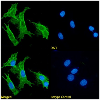 Anti-Glypican 3 [7H1]
