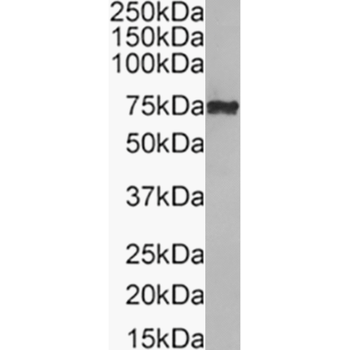 Anti-Glypican 3 [7H1]