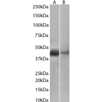 Anti-Cytokeratin 20 [10F6B12A9]
