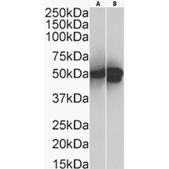 Anti-Cytokeratin 17 [4D2]