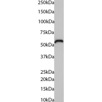 Anti-Cytokeratin 5/6 [AbM58019-7H4]