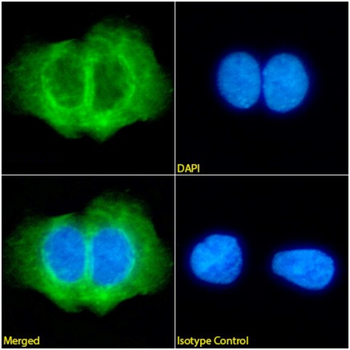 Anti-Cytokeratin 5/6 [AbM58019-7H4]