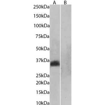 Anti-Aquaporin 4 [D15107]