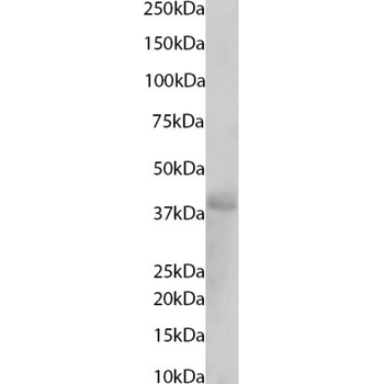 Anti-FOLR1 [Farletuzumab (MORAb-003; M3)]