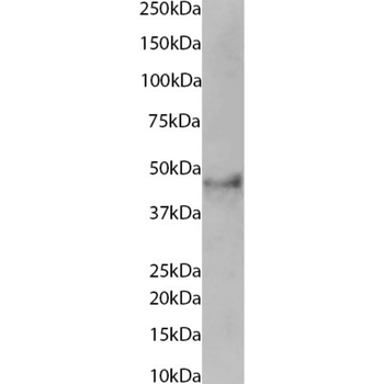 Anti-CD23 [IDEC-152 (Lumiliximab, 6G5) ]