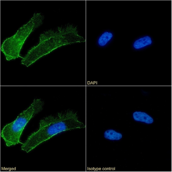 Anti-N-cadherin [8C11]