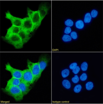 Anti-desmoglein-3 [5G11]