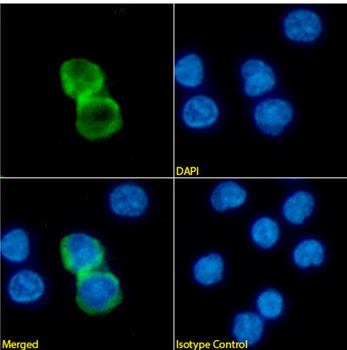 Anti-CD39 [CAT 13.9B4]