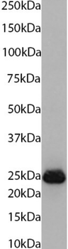 Anti-Siderocalin [MAB1857]