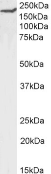Anti-CD45RA or A/B [OX-30]