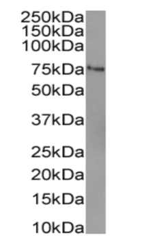 Anti-CD204 [2F8 (recombinant version)]