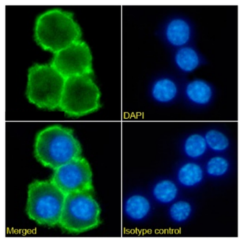 Anti-CD169 [SER-4 (recombinant version)]