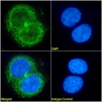 Anti-Ferritin [AMB8LK]