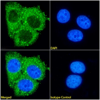 Anti-Ferritin [F11 (HSF102)]