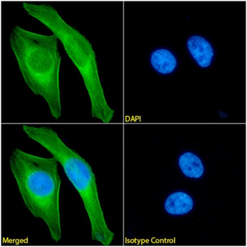 Anti-Ferritin H [4C9]
