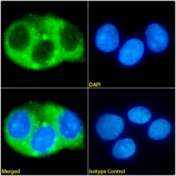 Anti-Apolipoprotein B-100 [MabB9]