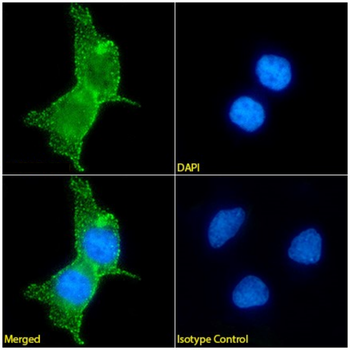 Anti-Mesothelin [MN-1]
