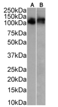 Anti-Thrombomodulin [QBEND/40]