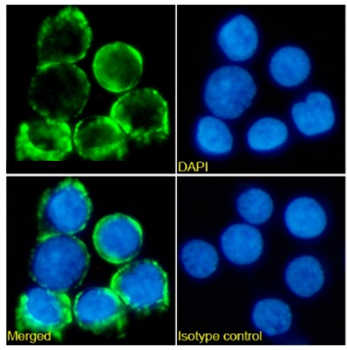 Anti-TCR beta [IARC307]
