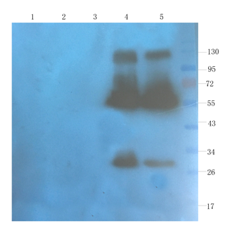 Anti-CD40L [hu5c8 (Ruplizumab)]