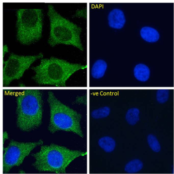 Anti-DC-SIGNR [16E7]
