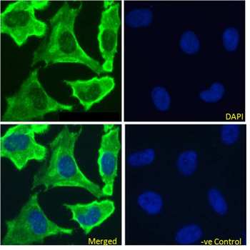 Anti-EGFR [528]