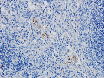 Anti-CD4 [YNB46.1.8 (Campath-9H)]