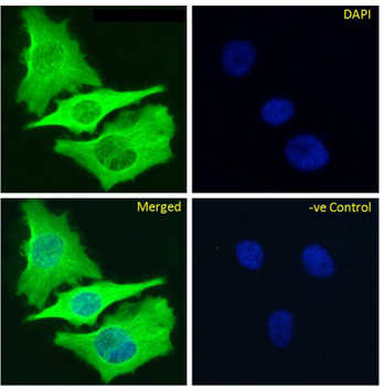 Anti-Beta-Tubulin [S11B]