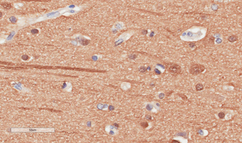 Anti-Beta-Tubulin [S11B]