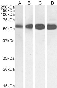 Anti-Beta-Tubulin [S11B]