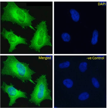 Anti-Fibronectin [A2]