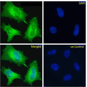 Anti-Fibronectin [A2]