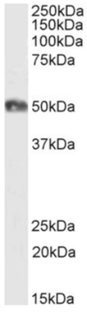 Anti-CD2 [YTH 655]