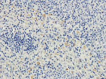 Anti-CD28 [JJ316]