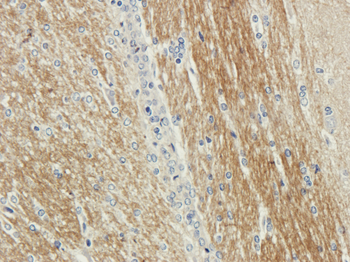 Anti-CDCrel-1 [SP18]