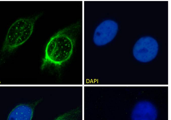Anti-Membrane type 1 metalloprotease [LEM-2/15]