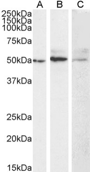 Anti-Membrane type 1 metalloprotease [LEM-2/15]