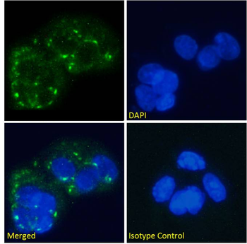Anti-Human Glucagon Receptor [hGR-2 F6]