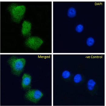 Anti-Glucose-dependent insulinotropic Receptor [Gipg013]