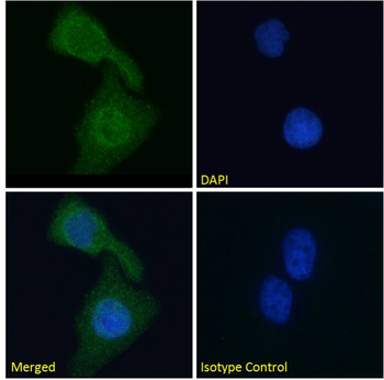 Rabbit Monoclonal Antibody to Cardiac Troponin I