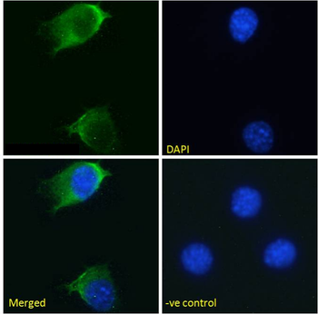 Anti-EGFR [S3 12D]