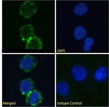 Anti-GPIIb/IIIa [10E5]