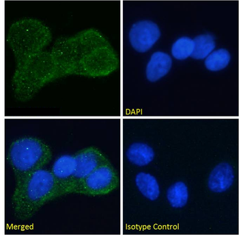 Anti-Insulin receptor alpha [Fab 83-7]