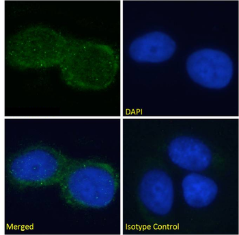 Anti-GM2 ganglioside [L55-81]