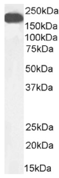 Anti-carcinoembryonic antigen [A5B7]