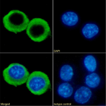 Anti-CCRL2 [BZ5B8]
