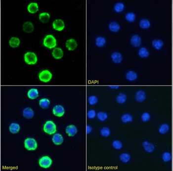 Anti-CD20 [18B12]
