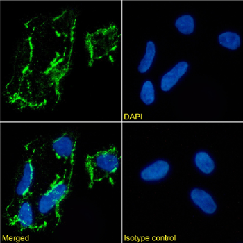 Anti-CD56 [NCAM12.19]
