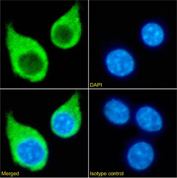 Anti-CD115/M-CSFR [AFS98]