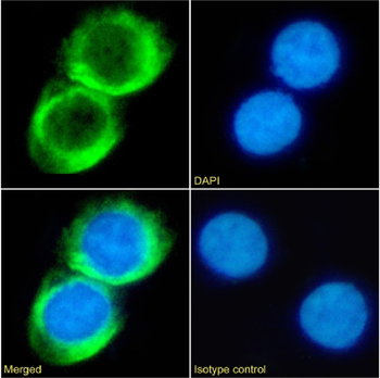 Anti-CD23 [CAT-13.9C1]
